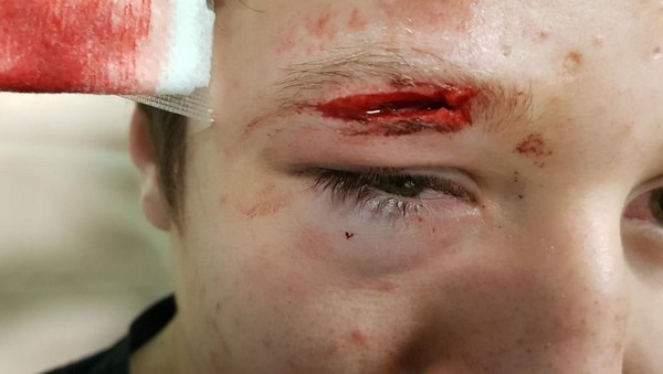 Un ado de 14 ans poignardé en défendant un garçon de 11 ans agressé par